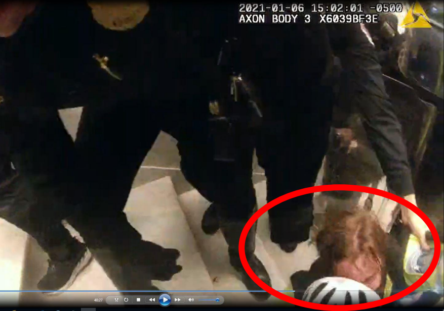 <em>Officer M.B. after falling down the stairs (DOJ)</em>