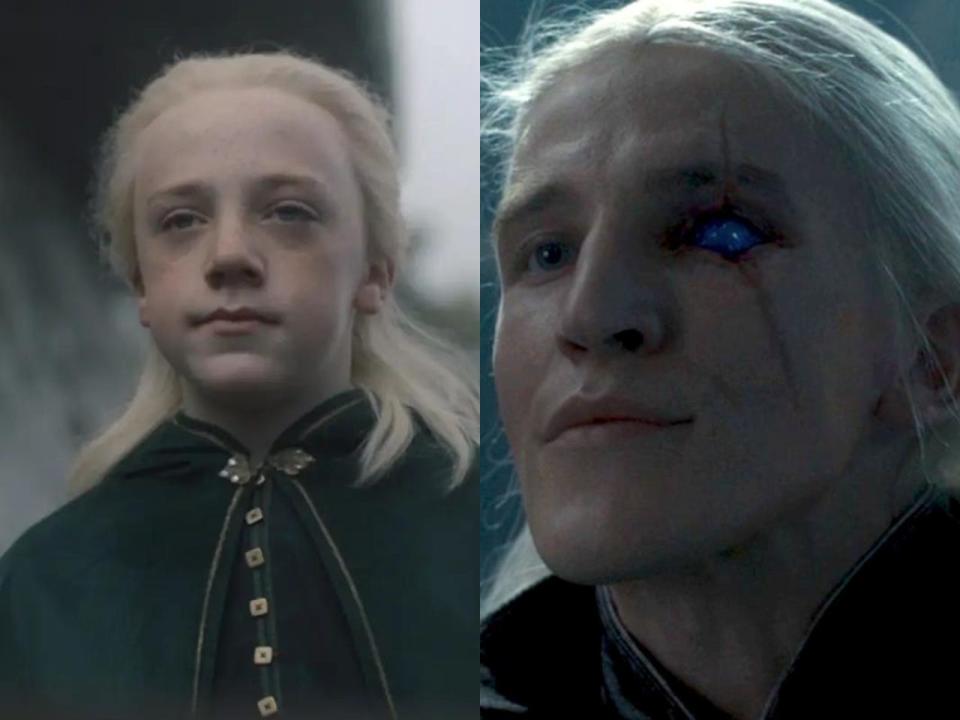 A side by side image of a young boy with white hair, and an older man with an eyepatch.