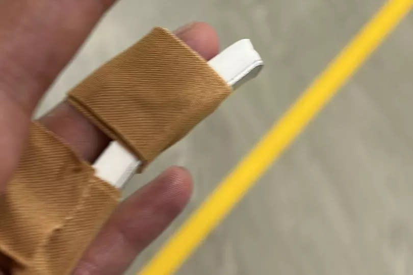 Danny suffered a fractured finger