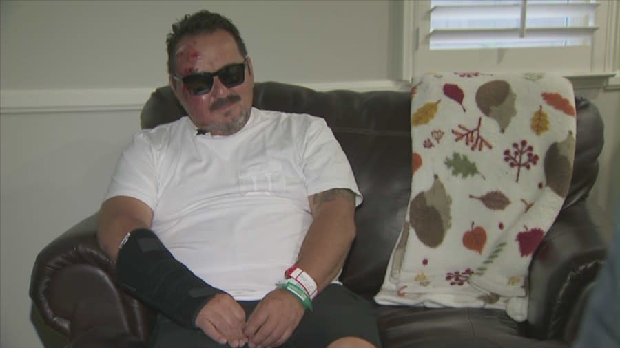 Alvaro Cortez, 53, was hospitalized after being struck by a hit-and-run driver in Riverside County. (KTLA)
