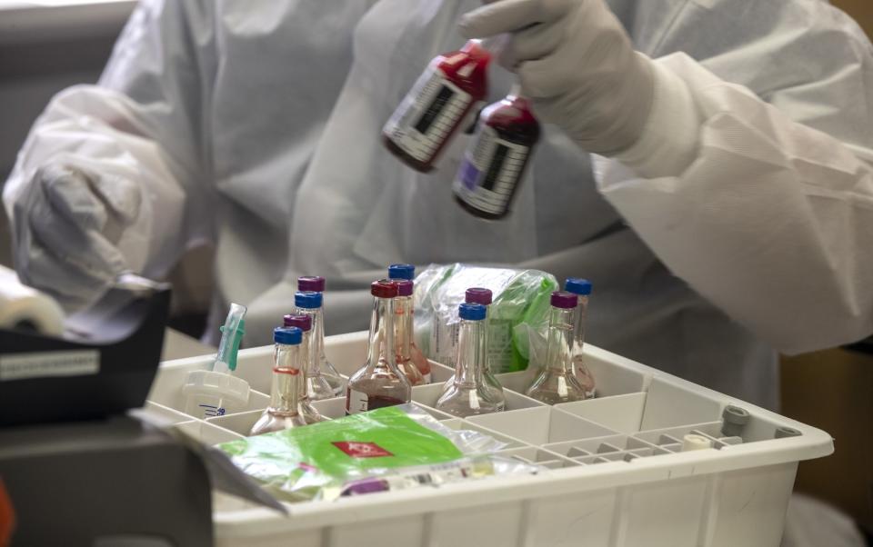 A technician processes specimens at the UCLA clinical microbiology lab in Brentwood.