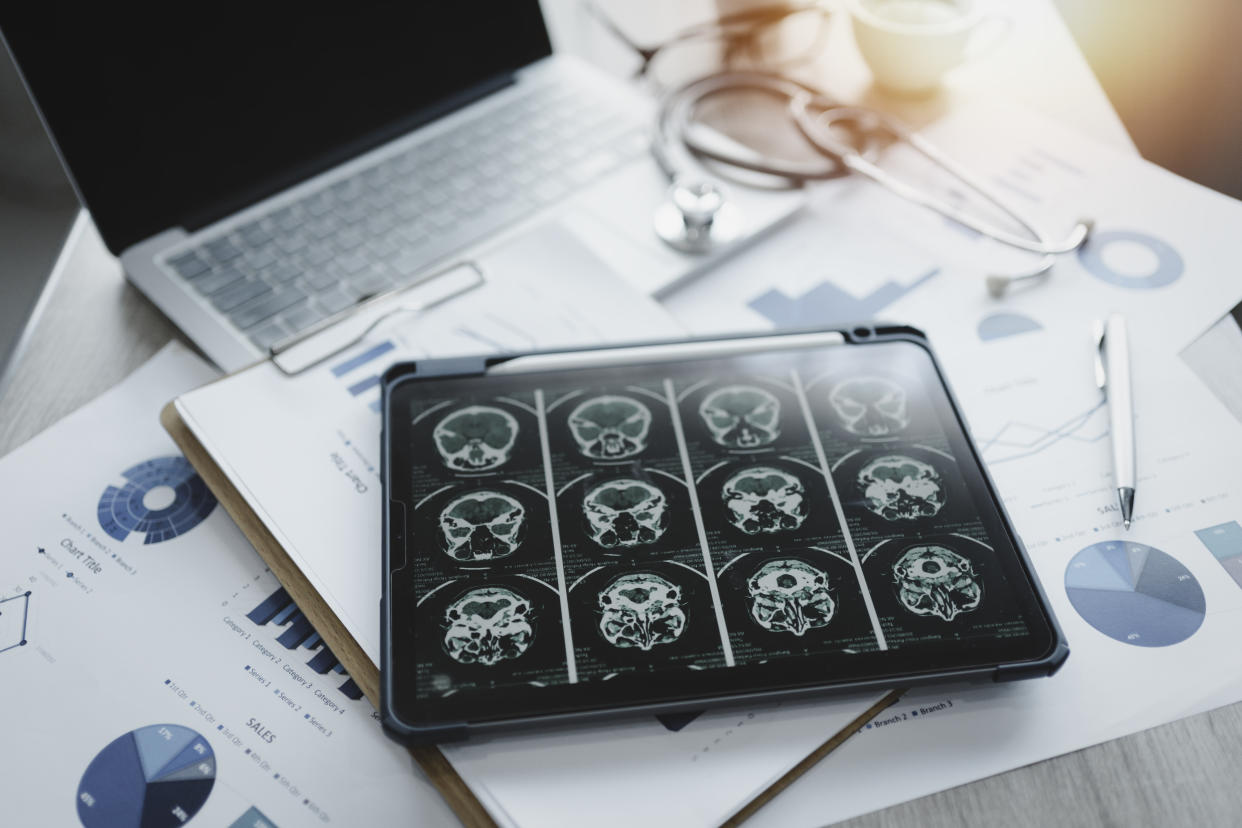 Close-up of a digital tablet with brain x-ray on screen.