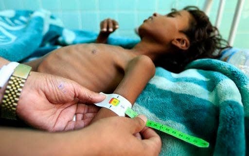 More than half a million children are at risk of starvation in Yemen's war-induce famine - UNICEF/AFP-Services/Mohammed Huwais