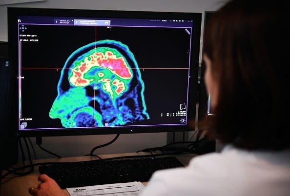 person looking at a brain scan