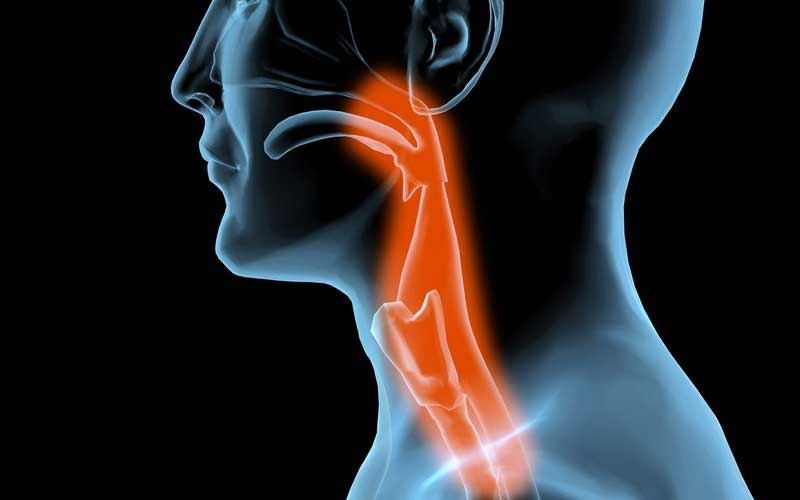 La disfagia, que es una alteración asociada a la dificultad o molestia de deglutir y está asociada al paso de los alimentos por la vía respiratoria, es muy frecuente en personas que han sufrido un ictus, ya que afecta a más del 45 por ciento durante su ingreso hospitalario. (Foto: Getty)