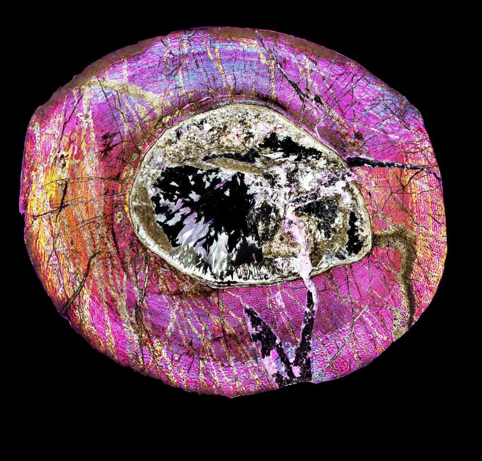 Microscopic image of a cross-section of bone tissue with many details present.