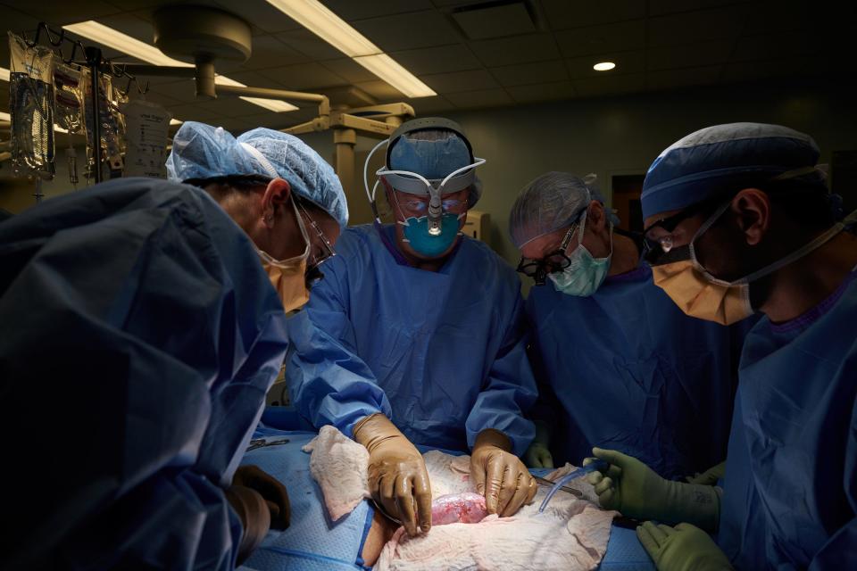 The surgical team at NYU Langone Health examines the pig kidney for any signs of rejection. The organ was implanted outside the body to allow for observation and tissue sampling during the 54-hour study period.