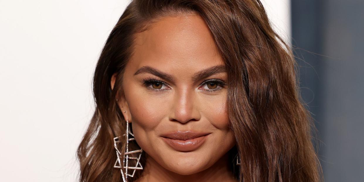 chrissy teigen buccal fat removal surgery