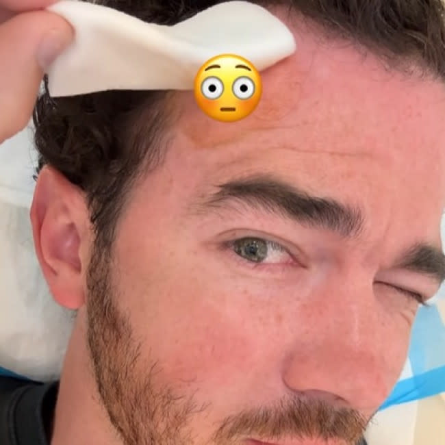 Kevin Jonas tras su operación (Instagram) credit:Bang Showbiz