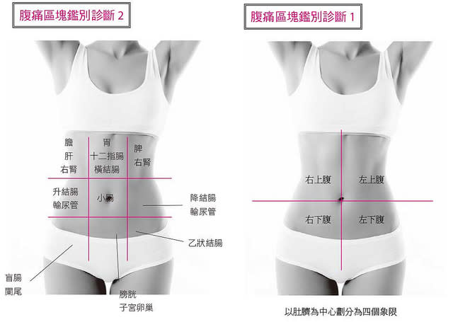 腹痛區塊鑑別診斷