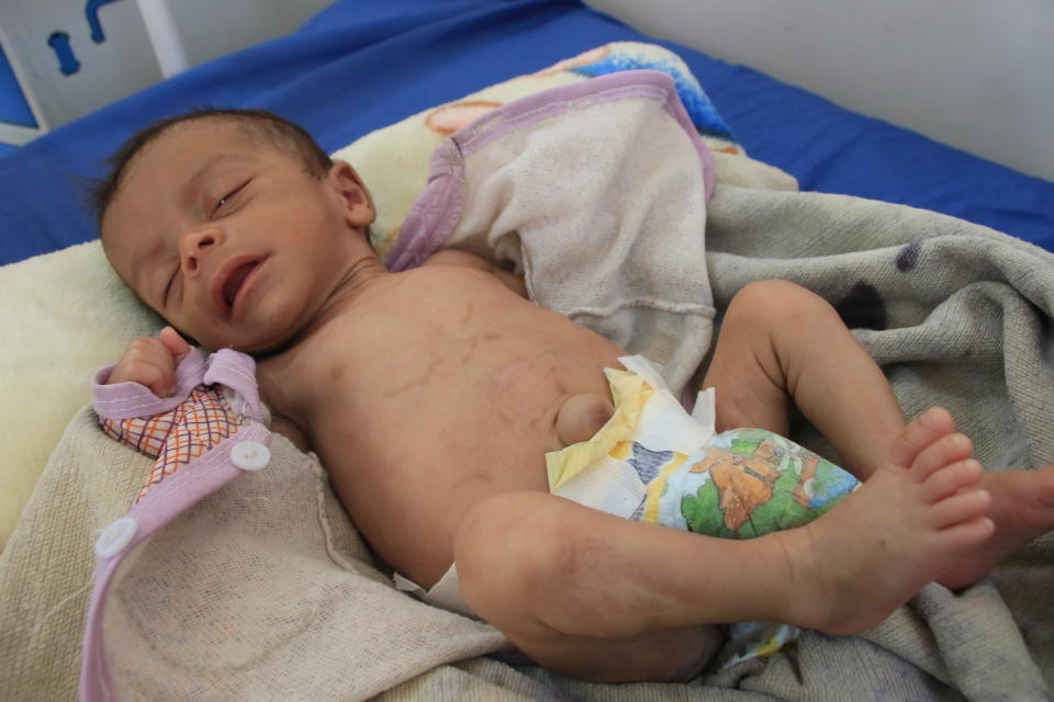 Faris is recovering after months of intensive treatment at the al-Jamhouri hospital. (Photo: Ahmad Algohbary)