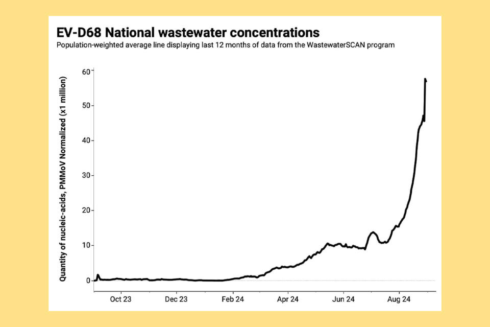 Virus that reasons paralyzing sickness is spiking within the U.S., wastewater information presentations