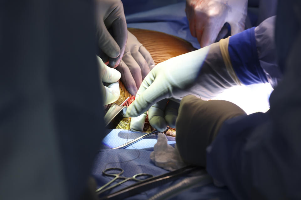 Surgeons perform the world’s first genetically modified pig kidney transplant into a living human at Massachusetts General Hospital, Saturday, March 16, 2024, in Boston, Mass. (Massachusetts General Hospital via AP)