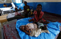 A severely acute malnourished and internally displaced Congolese child waits to receive medical attention at the Tshiamala general referral hospital of Mwene Ditu in Kasai Oriental Province in the Democratic Republic of Congo, March 15, 2018. Picture taken March 15, 2018. REUTERS/Thomas Mukoya