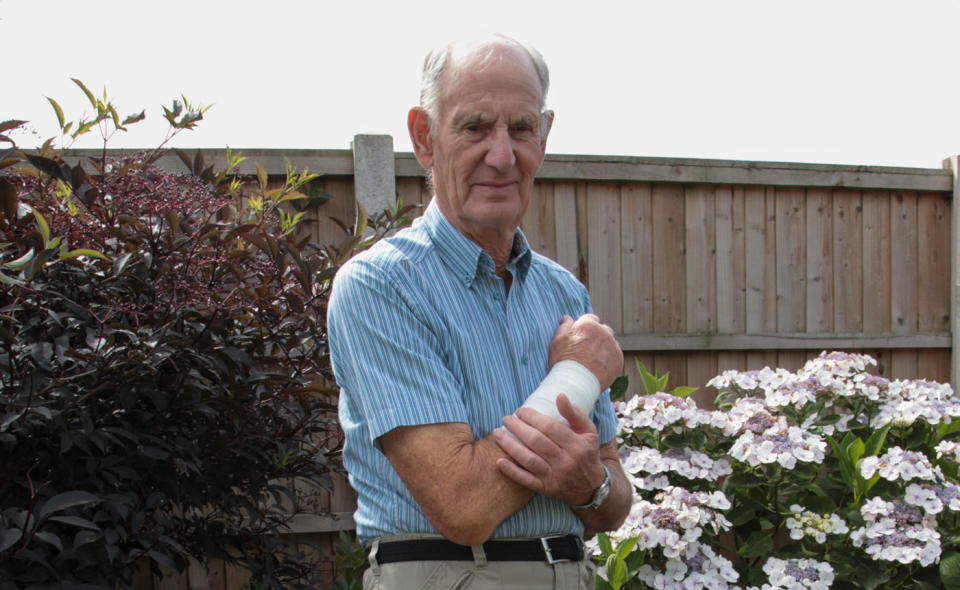 Pictured is Charles Brown, 82, nursing a bandaged arm. He claims he was attacked by a dog which ripped flesh off his arm. He was then left in a ditch while the owner and dog fled.