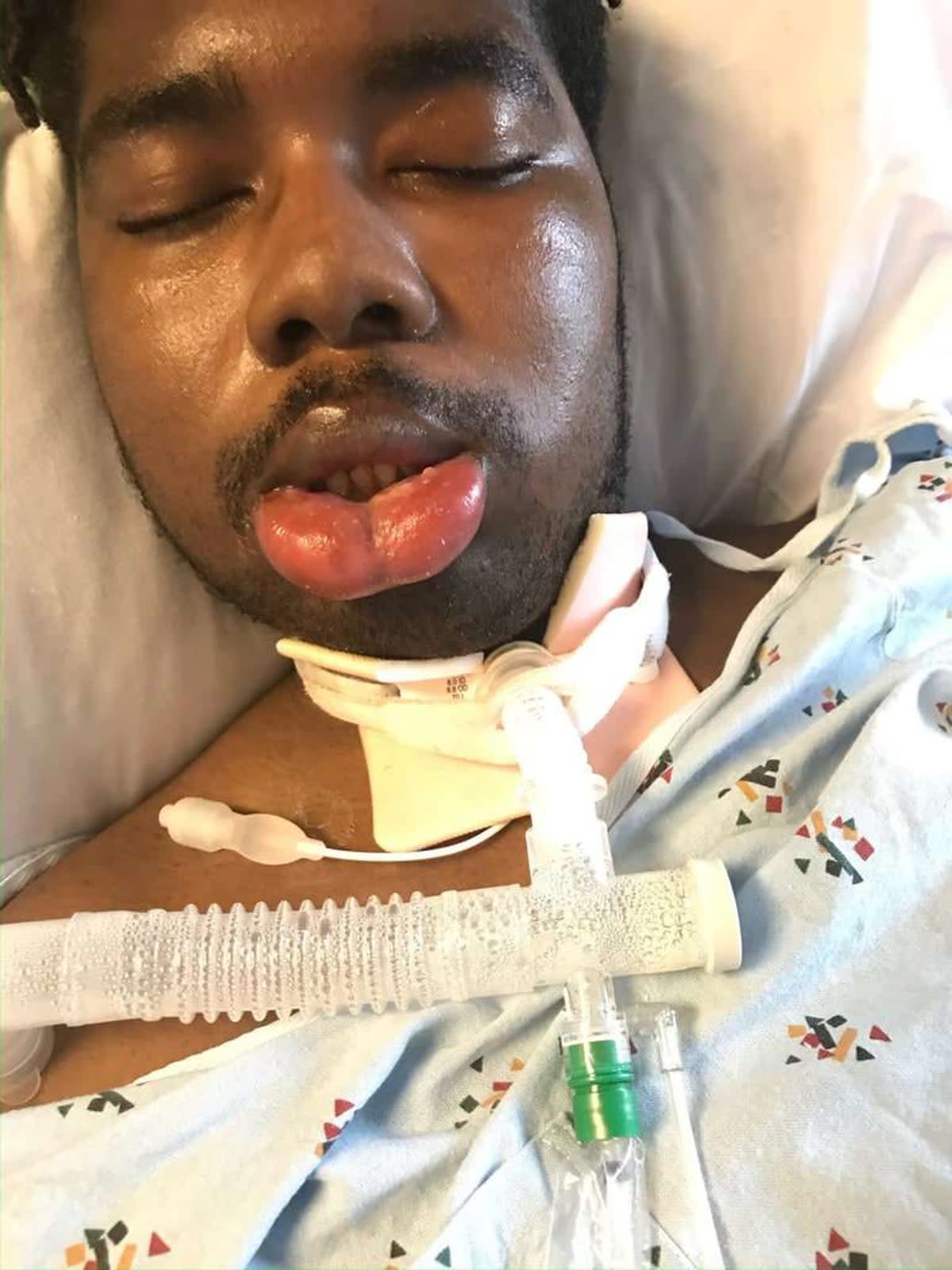 Nathaniel ‘NJ’ Foster after he suffered brain damage while disembarking from a United Airlines flight in 2019 (Stoll Law)