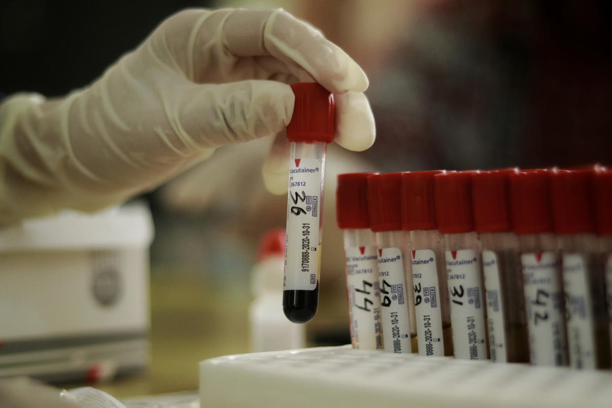 A medical arranging test tubes with blood samples for COVID-19 antibody testing at hospital in Bangka Belitung Islands, Indonesia, May 16, 2020. Based on Indonesian government data on Saturday, 529 new cases of Covid-19 in the last 24 hours, a total of 17,025 cases of Covid-19 in Indonesia. (Photo by Irwan Aulia Rachman / INA Photo Agency / Sipa USA)