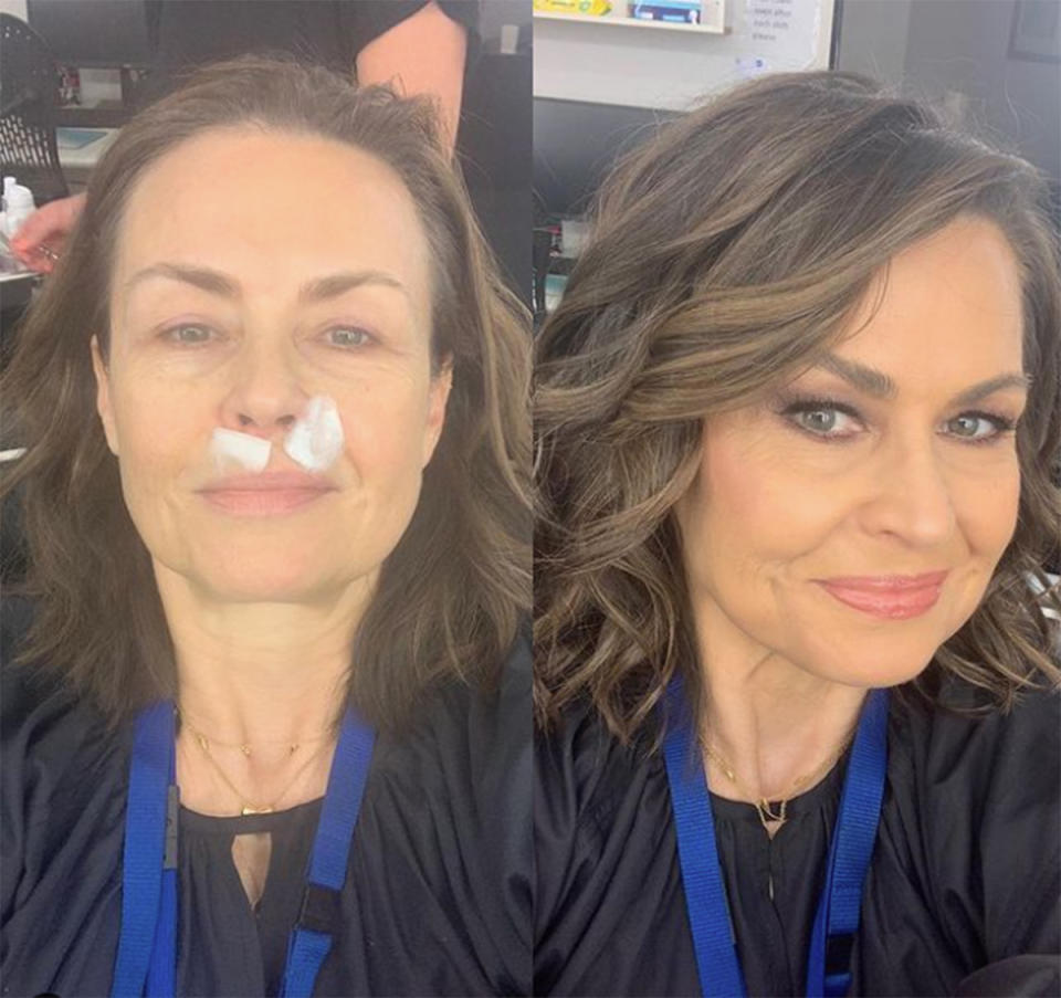 Lisa Wilkinson before and after the makeup chair