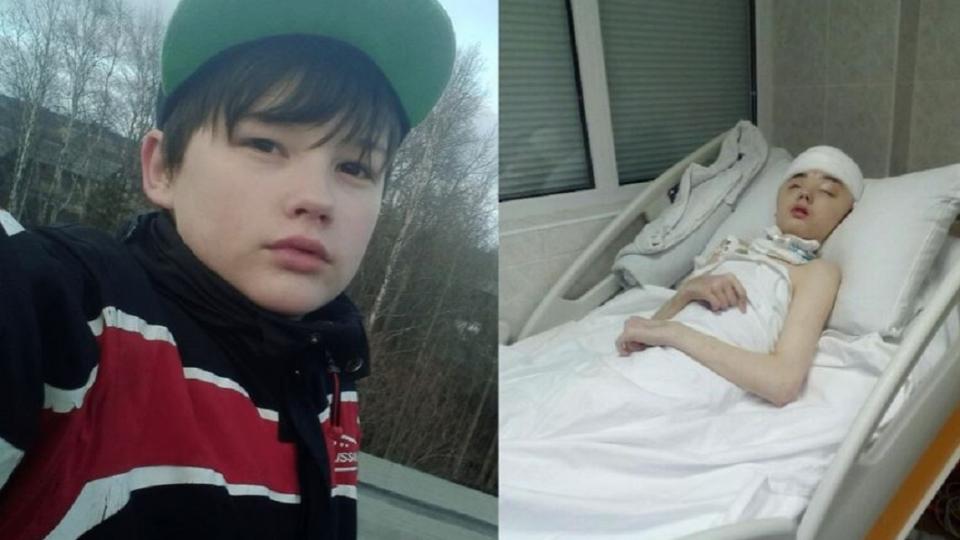 Vanya Krapivin lost most of his frontal skull bone while trying to save his mother from their neighbour. Images: Twitter/VK.com