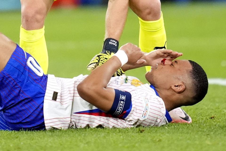 Mbappe broke his nose in France’s opening game (PA Wire)