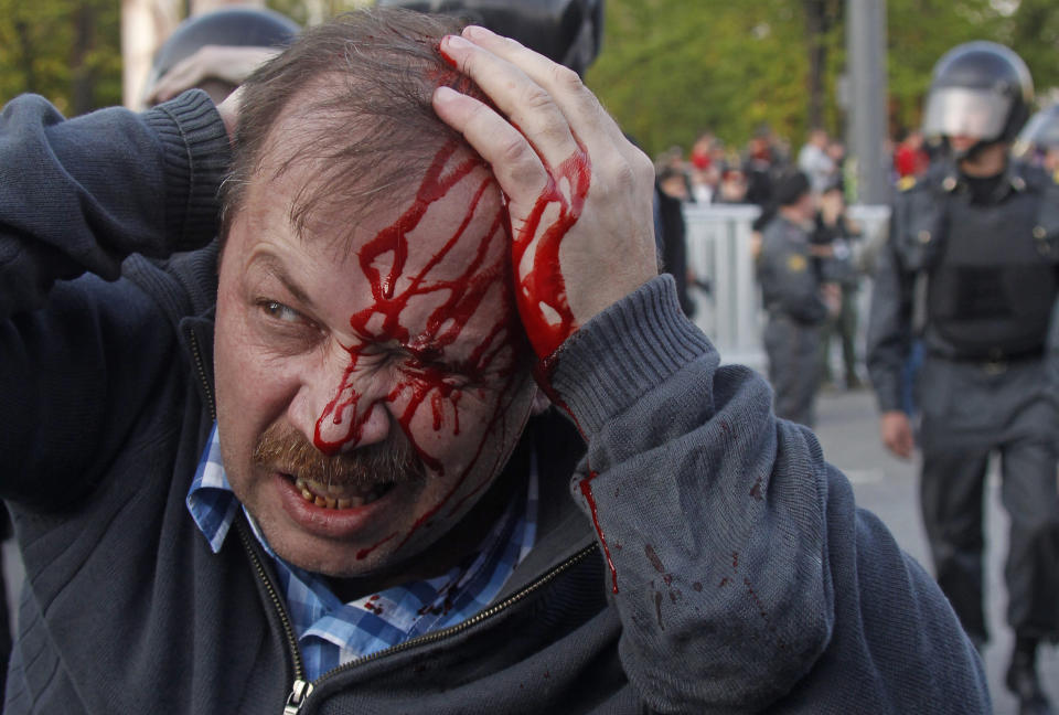 FILE - A wounded opposition protester winces in pain during a rally in Moscow, May 6, 2012. Riot police arrested protesters who were trying to reach the Kremlin in a demonstration on the eve of Vladimir Putin's inauguration as president. Over the last decade, Putin's Russia evolved from a country that tolerates at least some dissent to one that ruthlessly suppresses it. Arrests, trials and long prison terms — once rare — are commonplace. (AP Photo, File)