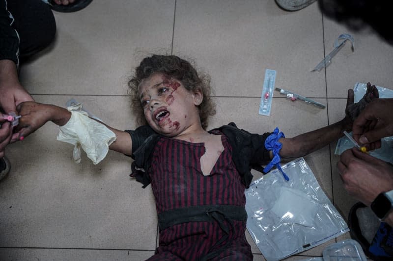 An injured child lies on the ground while getting treatment inside a hospital in Deir al Balah. Saher Alghorra/ZUMA Press Wire/dpa