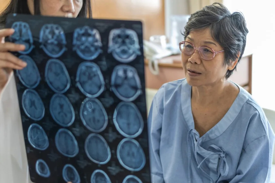 In the brains of Alzheimer’s patients, doctors have observed a buildup of a protein called tau, which is associated with the body’s immune response. Getty Images