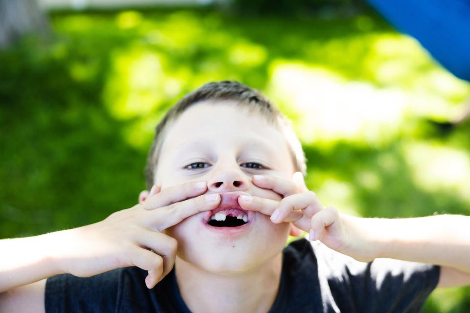 Eddie Perl, 7, shows off the gap in his teeth after losing a tooth while playing in the backyard of his home in Orem on June 21, 2023. | Ryan Sun, Deseret News