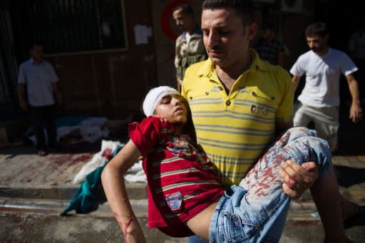 A man carries the body of a child who was wounded during shelling by Syrian government forces, near a bakery in the Tariq al-Bab district of the northern city of Aleppo. The shell struck the side of a building killing around ten people, and wounding at least 20 more as they queued to buy bread in the street below