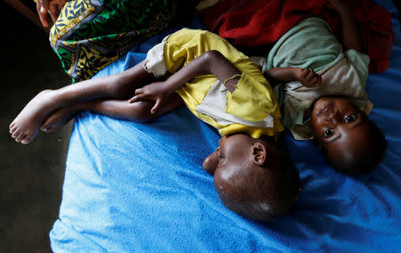 Severely acute malnourished and internally displaced Congolese children wait to receive medical attention at the Tshiamala general referral hospital of Mwene Ditu in Kasai Oriental Province in the Democratic Republic of Congo, March 15, 2018. Picture taken March 15, 2018. REUTERS/Thomas Mukoya