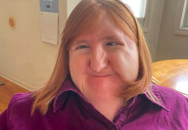 Blogger Melissa Blake opens up about the struggles of living with a disability via Instagram/ @melissablake81