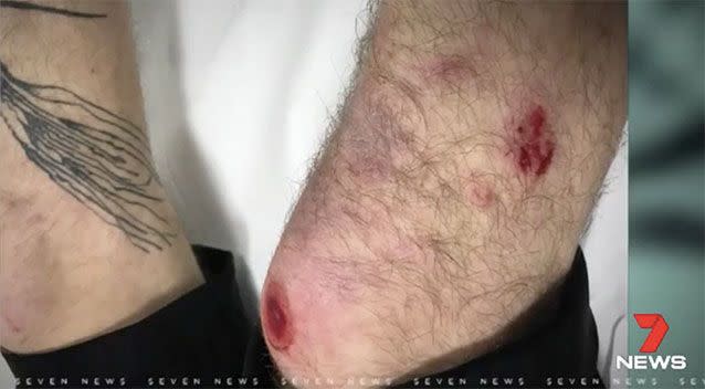 Mr Shida's scraped and bloodied leg. Source: 7 News