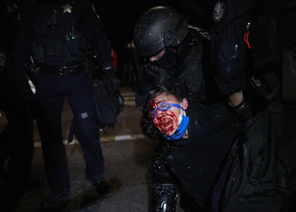 <div class="inline-image__caption"><p>A policeman arrested a protestor, who is injured in the face and bleeding, in Portland, Oregon, on September 4, 2020 during a march to denounce police brutality and systemic racism.</p></div> <div class="inline-image__credit">Allison Dinner/Getty</div>