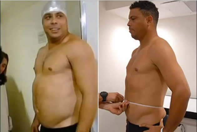 Ronaldo's before and after shots (youtube.com)