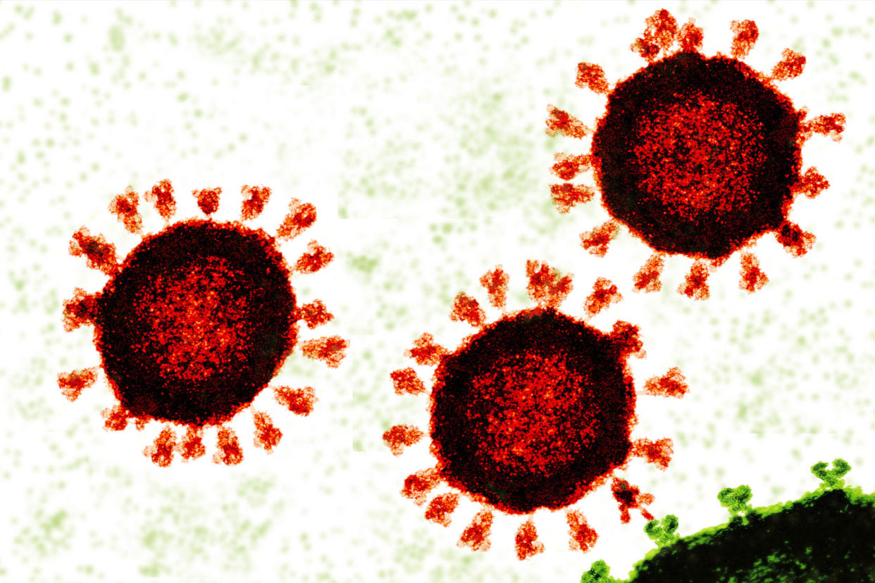 COVID-19 Coronavirus Getty Images/JUAN GAERTNER/SCIENCE PHOTO LIBRARY