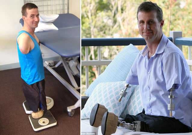 Mathew has six months before the surgery will take place. Photo: Supplied