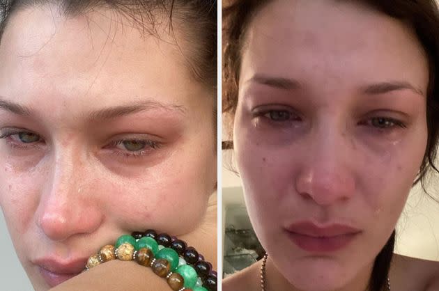 Bella Hadid has opened up about her depression and anxiety. (Photo: Bella Hadid Instagram)