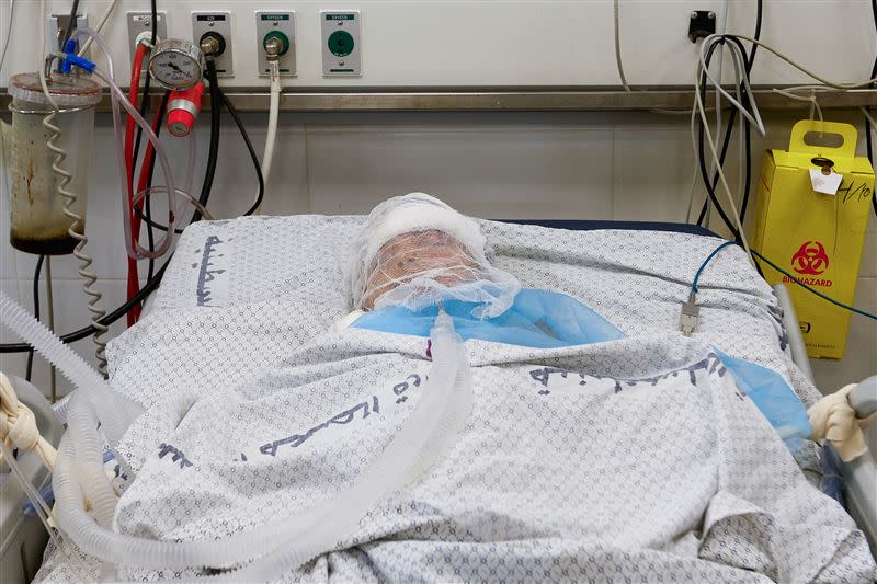 世界衛生組織（WHO）發言人林梅爾痛心指出，加薩走廊病患的處境，簡直比死亡還痛苦。（圖／路透／達志影像）