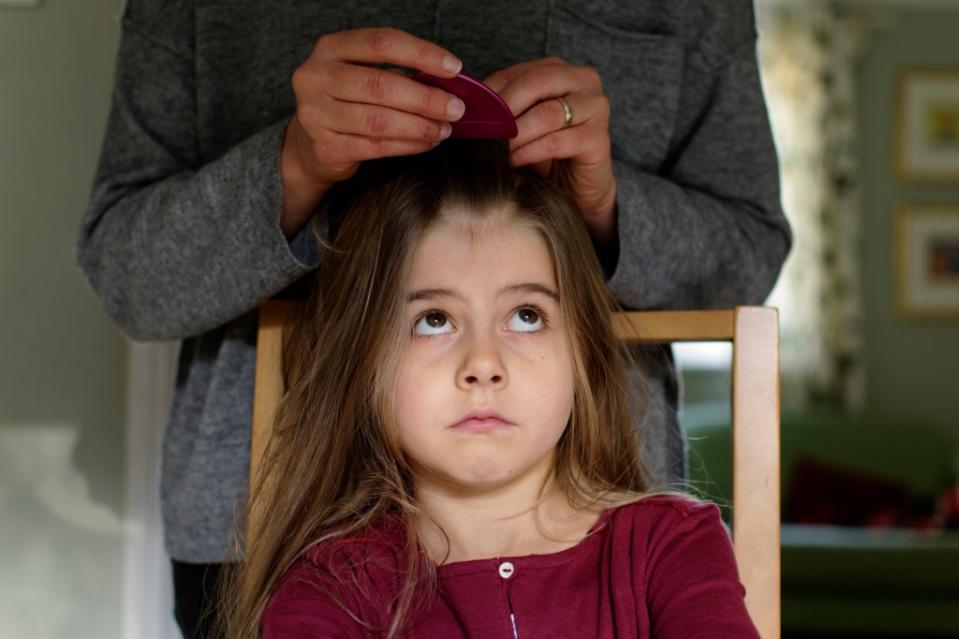 Can olive oil and mayo be used to get rid of lice? Here’s what experts say. Getty Images