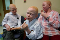 <p>Mwigulu Magesaa (L), 14, Baraka Lusambo, (C), 7, and Pendo Noni 16, wait in the lobby during prosthetic arm fittings at the Shriners Hospital in Philadelphia, Pa., May 30, 2017. All three are Tanzanians with albinism who had body parts chopped off in witchcraft-driven attacks. (Photo: Carlo Allegri/Reuters) </p>