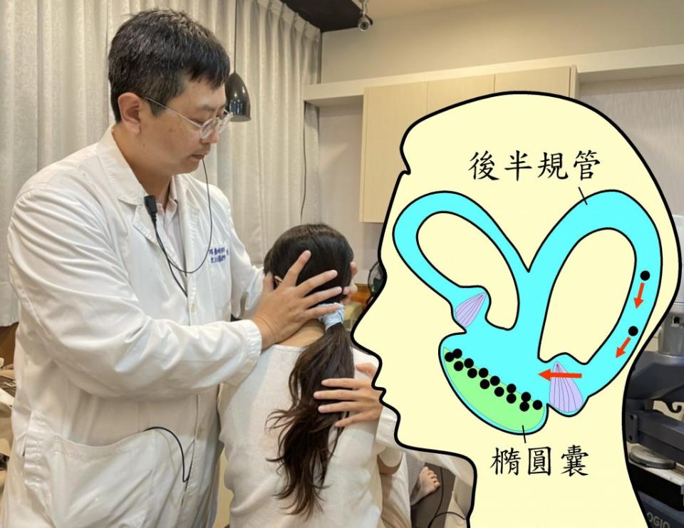 醫師陳建志以耳石復位術治療患者。（醫師陳建志提供）