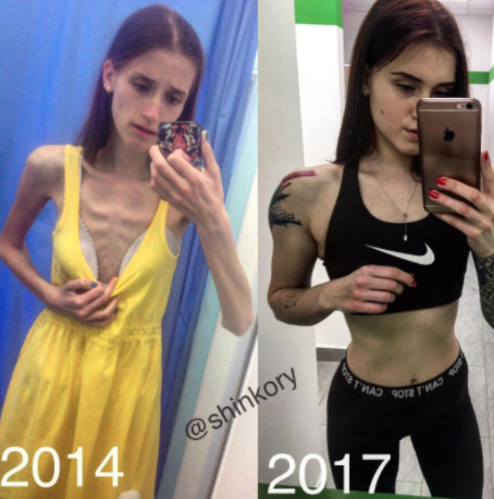 Superó la anorexia y ahora es una entrenadora de fitness