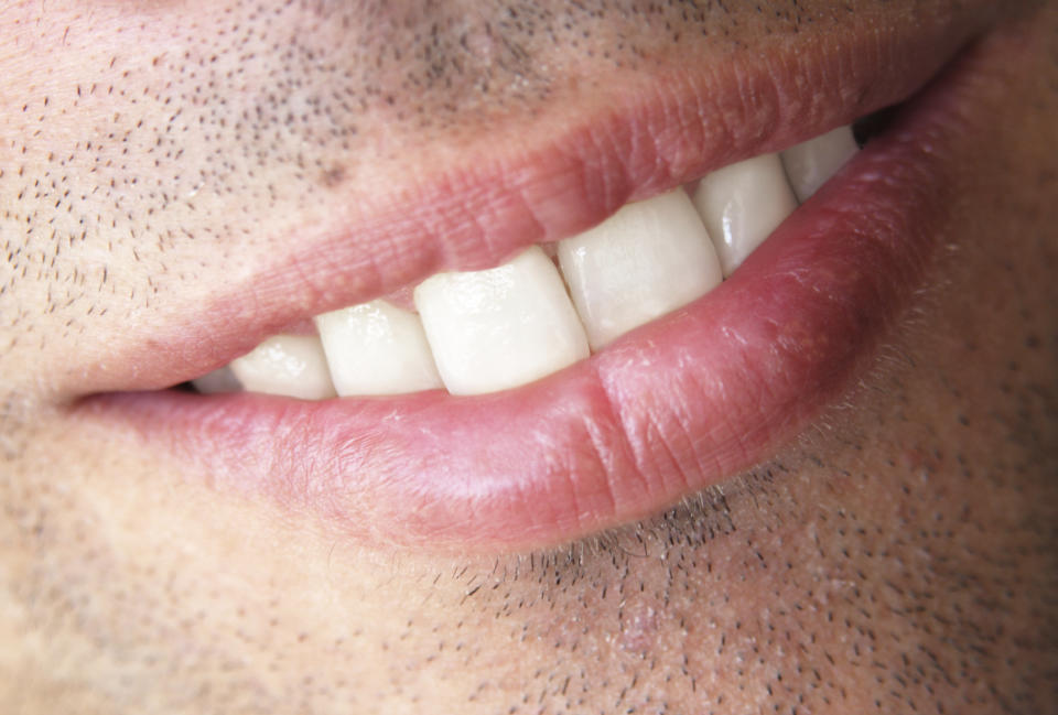 Son muy pocos los deportistas que acuden regularmente al dentista / Foto: iStockphoto