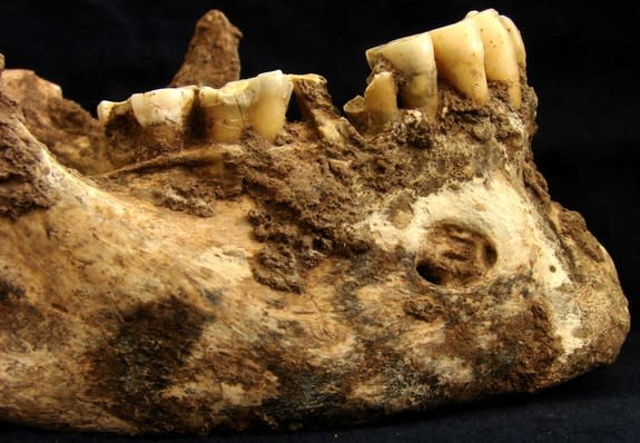 The mandible of a 30-something man buried in Rome's Castellaccio Europarco cemetery in the Imperial Period shows signs of cavities and an abscess. The bones revealed a high proportion of millet in the man's diet.