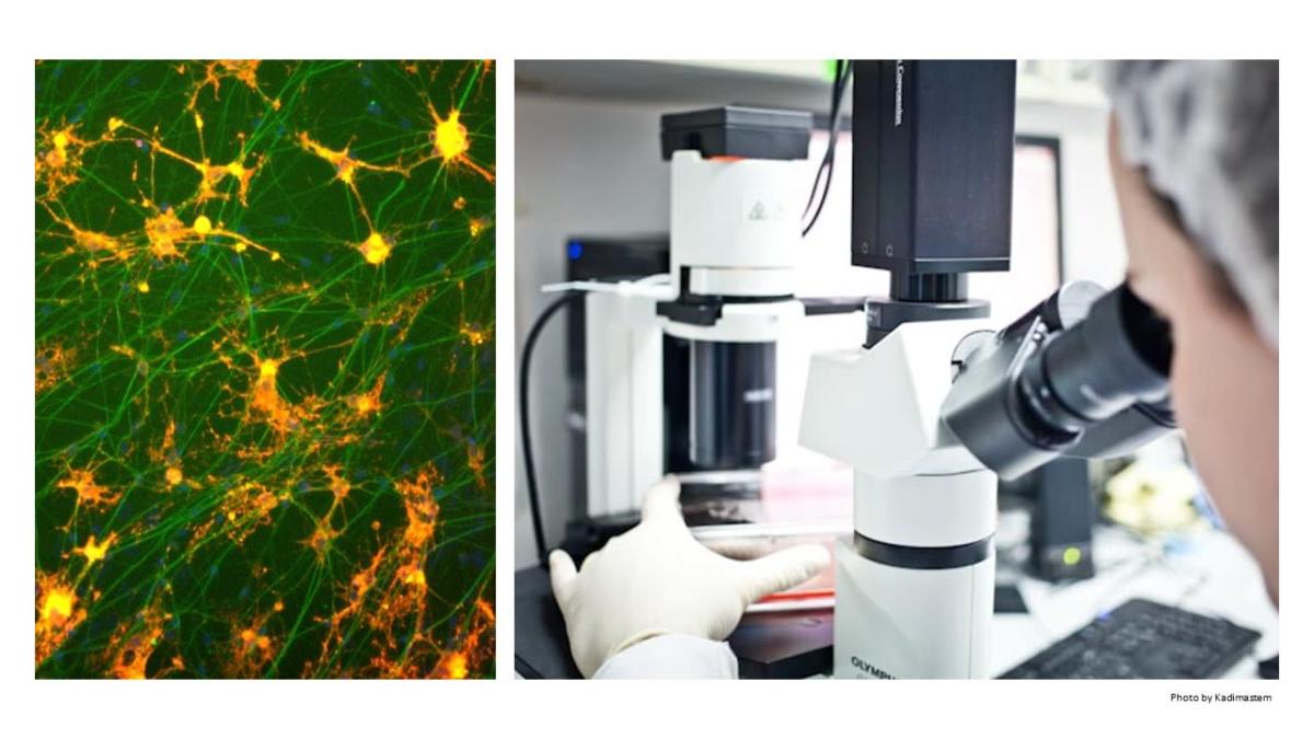 Kadimastem、ALSおよび薬物スクリーニングのためのAstroRx®の日本特許取得