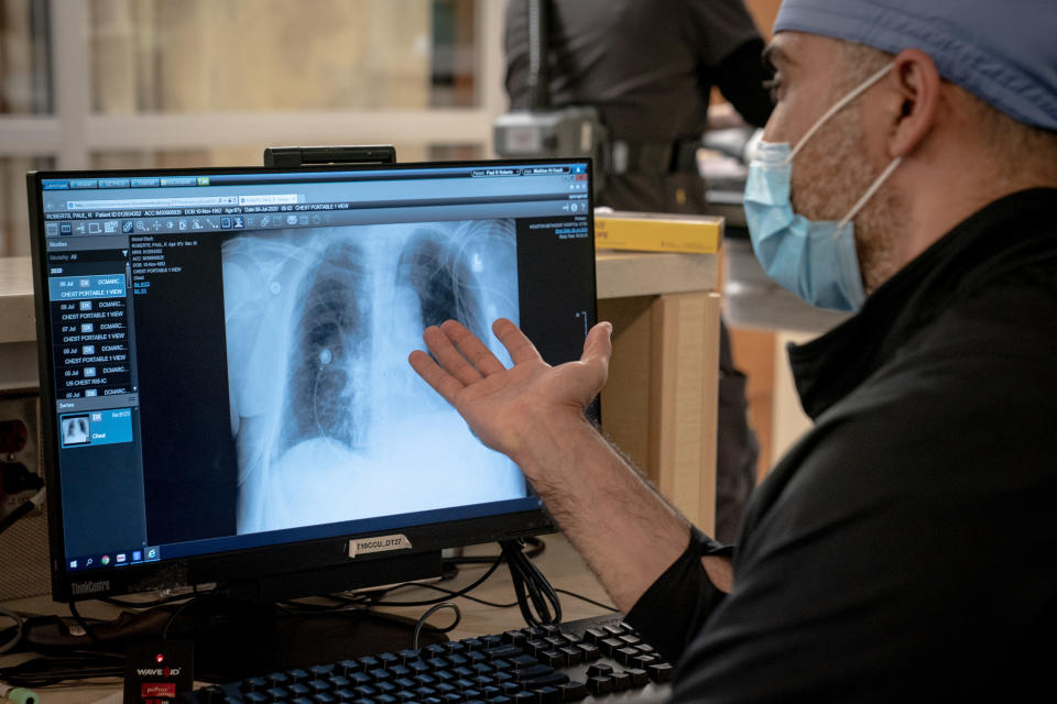 Mukhtar Al-Saadi con una placa de rayos X de Paul Roberts, quien sufre una enfermedad pulmonar crónica además de COVID-19, en el Hospital Metodista de Houston, en Houston, el 9 de julio de 2020. (Erin Schaff/The New York Times)