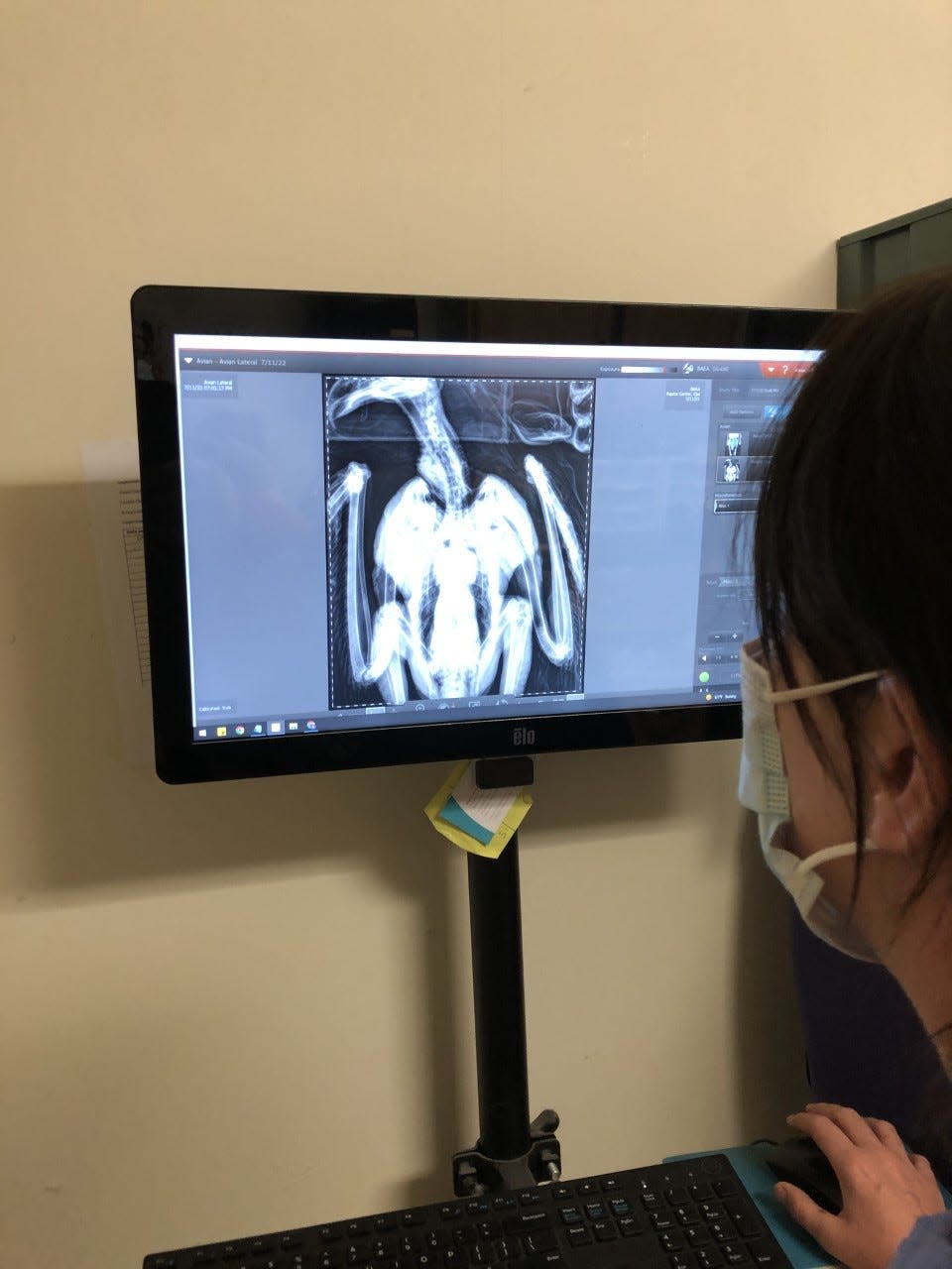 Staff at the Ojai Raptor Center took radiographs of an eaglet rescued after falling out of a nest on Santa Cruz Island.