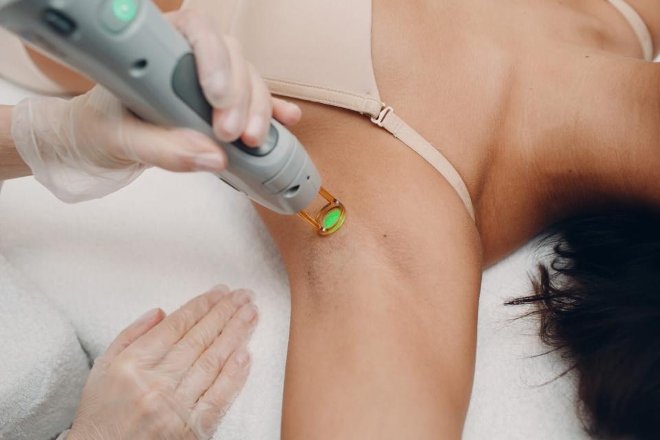 How to Get Laser Hair Removal In the Summer Without Burning Your Skin Off