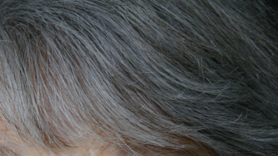 An image of an eldery woman's graying hair.