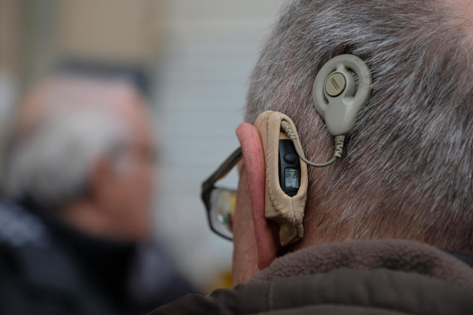 NHS An adult person suffering with severe, permanent hearing loss and a problem with auditory nerve using an auditory brainstem implant (ABI) device.